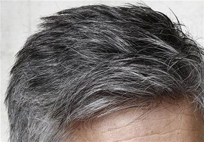 چگونه از سفیدی موها جلوگیری کنیم؟