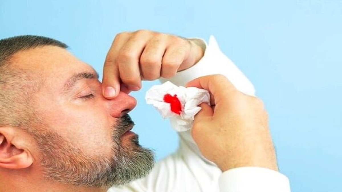 این توصیه‌های مهم در خصوص خونریزی بینی در گرما را جدی بگیرید